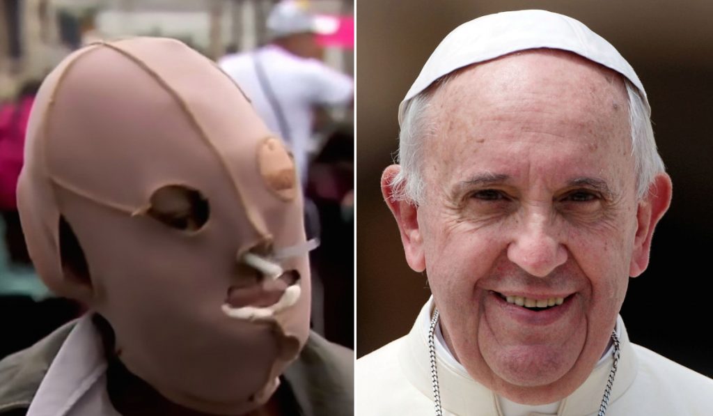 Pope Francis with acid victim